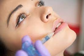 Lip Filler Side Effects: What to Watch For