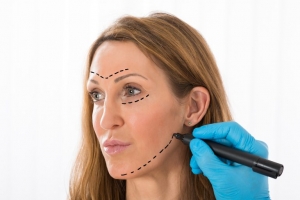 What Makes a Facelift Different from Thread Lifting?