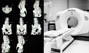 Understanding CT Scans – Expert Answers to Help You Make Informed Decisions