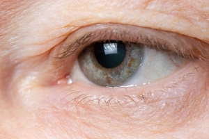 Say Goodbye to Tired Eyes: How Blepharoplasty Transforms Your Appearance