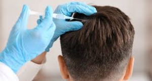 PRP in Islamabad – The Science of Platelet Therapy