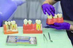 Why Choose Dental Implants Burton on Trent for Affordable Tooth Restoration