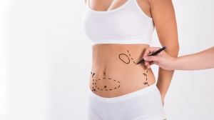 Choosing the Best Surgeon for Liposuction in Islamabad