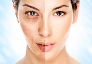 Facelift Surgery and Skin Health: Combining Procedures for Optimal Results