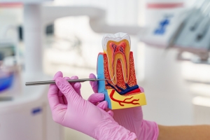 Family Dentistry Guide: When to Consider a Root Canal 