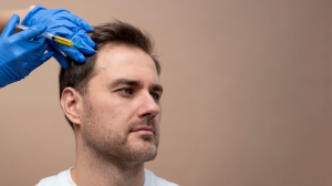 What Happens During a PRP Hair Session?