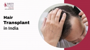 How Does the Number of Grafts Determine Your Hair Transplant Cost?