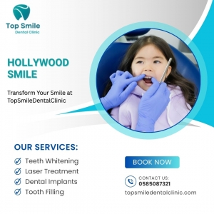 Hollywood Smile in Dubai – Get Your Perfect Smile at TopSmileDentalClinic