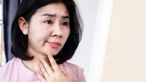 Acupuncture for Bell’s Palsy: Regaining Facial Function and Confidence