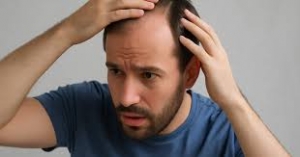 How Age Affects Hair Loss: Prevention Strategies for Men in Their 20s, 30s, 40s, 50s