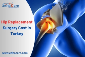 Knee Replacement Surgery in India – Procedure, Cost & Role of EdhaCare