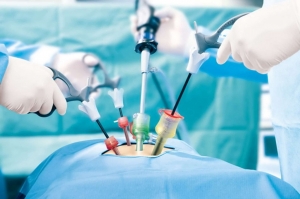 Advanced Laparoscopic Surgery in Lucknow – Quick Recovery & Care