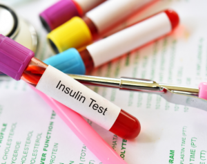 Insulin Resistance Symptoms You Shouldn’t Ignore: When to Consider a Blood Test