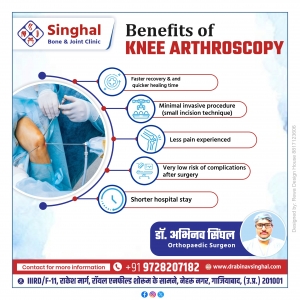 Benefits of Knee Arthroscopy – Insights from the Top Arthroscopy Doctors in Ghaziabad