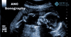 Antenatal Care Ultrasound in Thane
