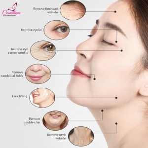 Liquid Facelift with Fillers: The Secret to a Brides Glow.