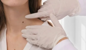 Why Choose Skin Tag Removal in Islamabad?