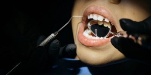 Tooth Extraction Side Effects, Procedure, and Costs in Tanjong Pagar