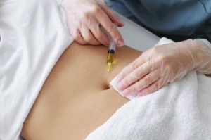 Fat Dissolving Injections Nottingham: A Safe Alternative to Surgery