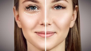 Is Eye Bag Removal in Islamabad Worth the Price?