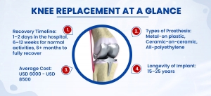 Knee Replacement Surgery in India: Procedure, Cost & What to Expect After Surgery