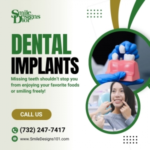 How Painful Are All-on-4 Dental Implants? A Complete Guide for Somerset Smiles
