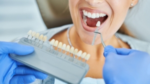 3 Surprising Ways Opalescence Teeth Whitening Is Changing Smiles in 2025