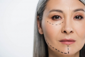 Can You Shine Boldly Every Day with Facelift Surgery Cost in Dubai?