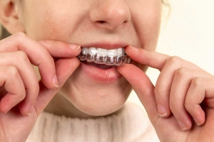 Dental Hygiene Tips Every Leeds Resident Should Know