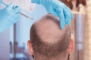 What Factors Should You Consider Before Choosing a UK Hair Transplant Clinic in Leeds?