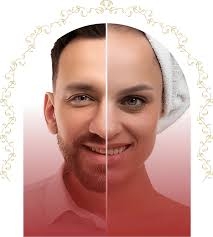 Gender Reassignment Surgery in India: A Complete Guide
