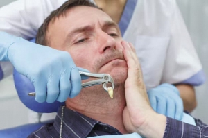Tooth Extraction Options That Provide Safe and Comfortable Patient Experiences