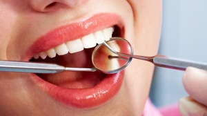 How Dental Hygienists Improve Oral Health at Every Visit