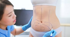 How to Achieve Lasting Results with Lipo Abdominoplasty in Riyadh