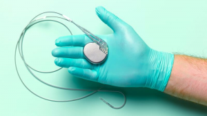 How Successful Is Pacemaker Surgery in Treating Arrhythmias?