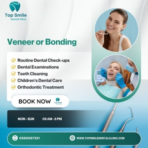 Veneer or Bonding – Transform Your Smile at Top Smile Dental Clinic