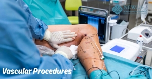 Vascular Procedures in Thane