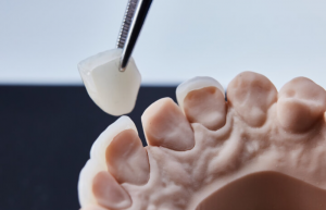 Choosing the Right Material for Your Dental Crown: A Guide to Zirconia vs. Porcelain in Prairie Village, KS