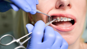 The Importance of Early Orthodontic Evaluation with Panorex X-Rays for Children in Huntingburg, IN