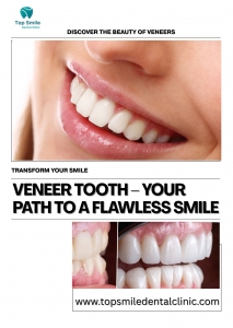 ✨ Veneer Tooth Treatment – Get Your Perfect Smile Today! ✨