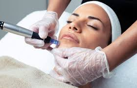 Can Microneedling Help with Sun Damage? Dubai Experts Explain