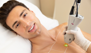 Smooth Skin Confidence with Candela Laser Hair Removal