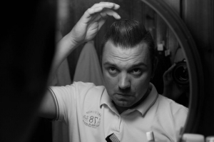 What Happens One Year After a Hair Transplant