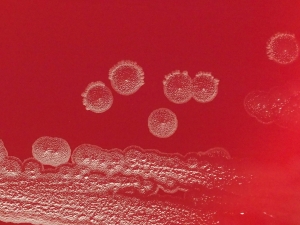 Stem Cell Treatment in India