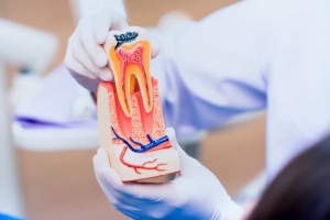 Choosing the Right Dentist for Root Canal Treatments in Santa Monica