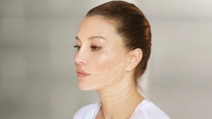 Thread Lift in Islamabad: Ideal Candidates