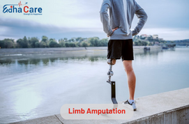 Limb Amputation: A Vital Orthopedic Treatment inIndia
