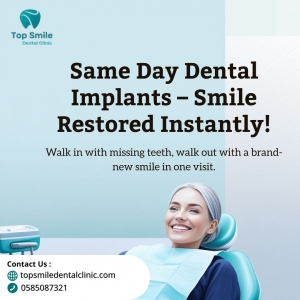 Same Day Dental Implants: A Faster Way to Restore Your Smile