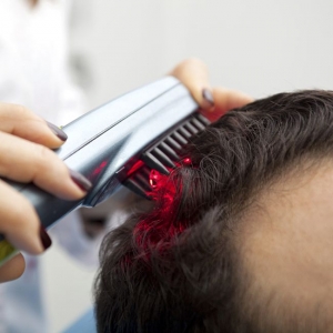How Laser Hair Therapy Works on Hair Follicles?