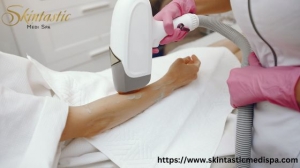 Discover the Benefits of Safe Laser Hair Removal in Riverside
